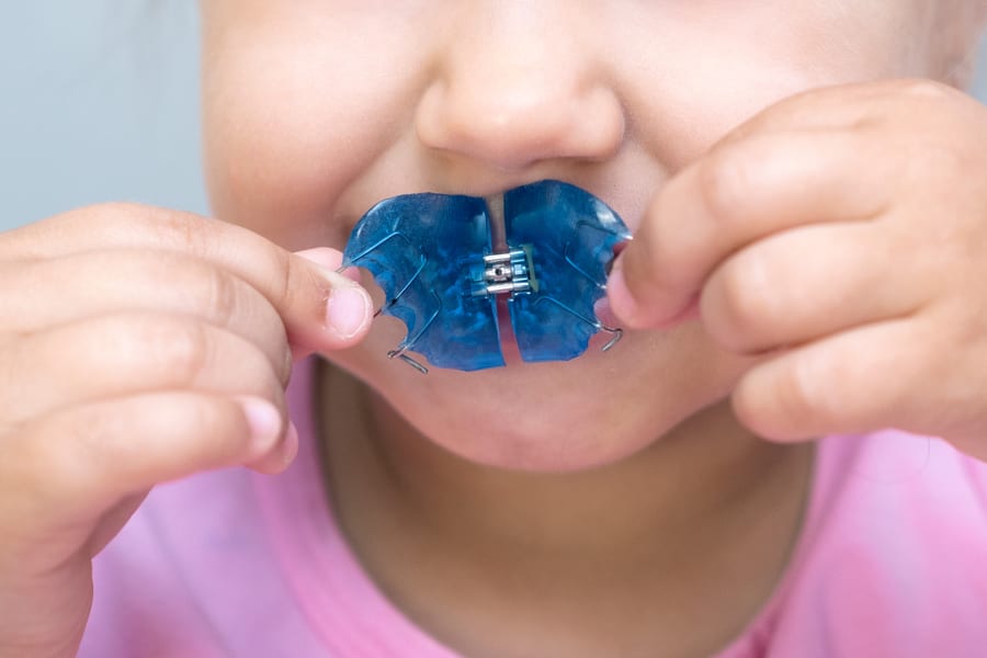 Sesión de logopedia miofuncional con paciente que lleva expansor palatino: reeducación de postura lingual, sello labial y respiración nasal en consulta especializada de Tenerife.